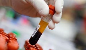 100% for NHA laboratory